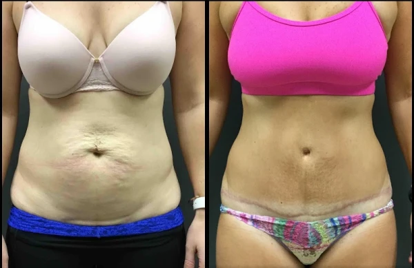 la-belle-vie-plastic-surgery-4.jpg