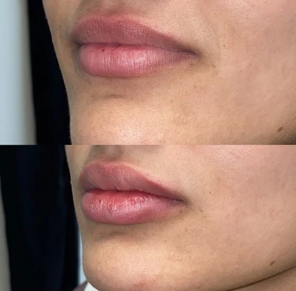 norcal-plastic-surgery-1.jpg