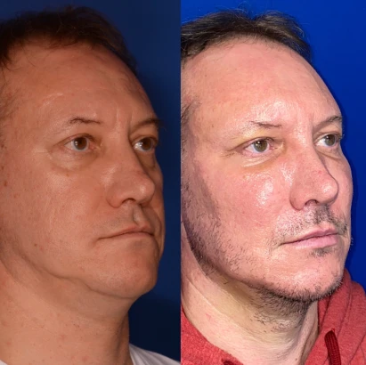 norcal-plastic-surgery-3.png