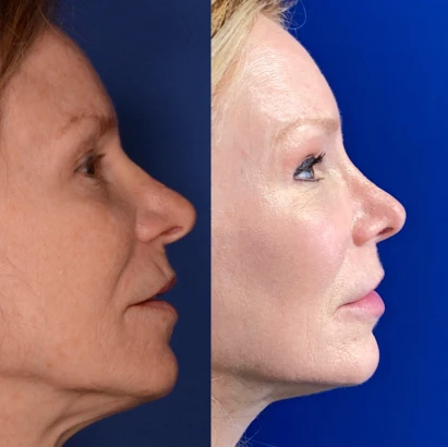 norcal-plastic-surgery-4.png