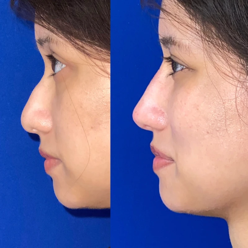 NorCal Plastic Surgery, Walnut Creek, California, 94596