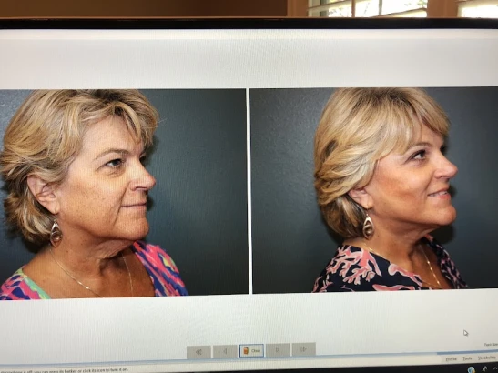 bayside-center-for-plastic-surgery-tampa-1.jpg