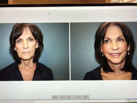bayside-center-for-plastic-surgery-tampa-4.jpg