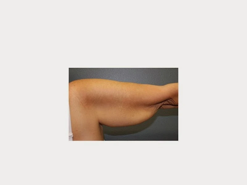 Bayside Center for Plastic Surgery Tampa