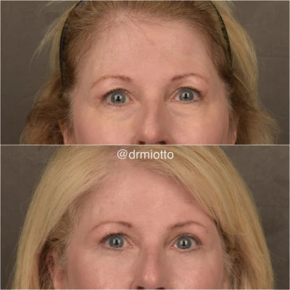 me-plastic-surgery-dr-gabriele-miotto-2.jpg