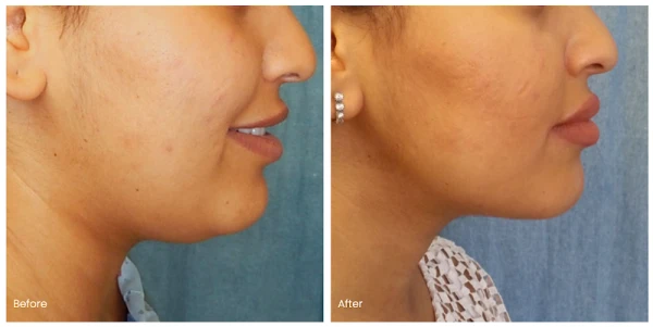 belmont-plastic-surgery-2.png