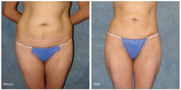 belmont-plastic-surgery-3.png