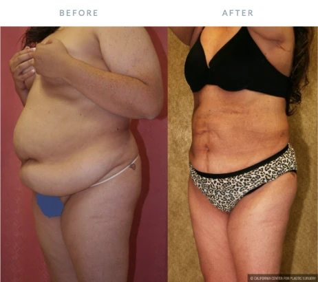 dr-sean-younai-irwindale-plastic-surgeon-1.png