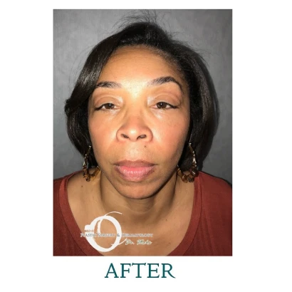 90210-cosmetic-surgery-and-dermatology-2.jpg