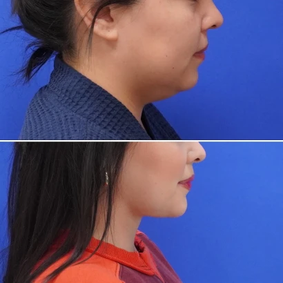 avance-plastic-surgery-institute-dr-erez-dayan-1.jpg