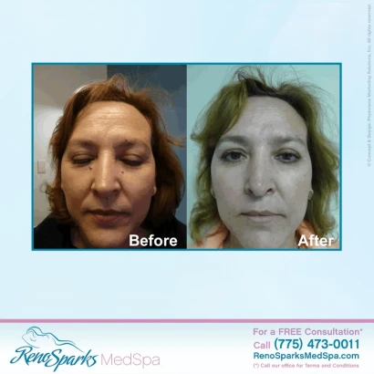 reno-sparks-medspa-1.jpg