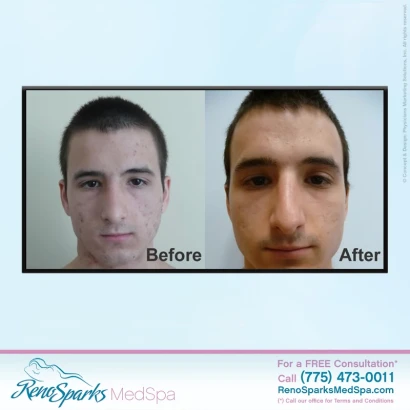 reno-sparks-medspa-2.jpg