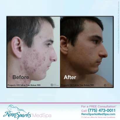 reno-sparks-medspa-3.jpg
