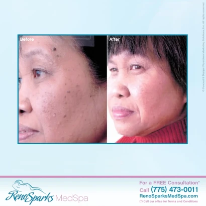 reno-sparks-medspa-4.jpg