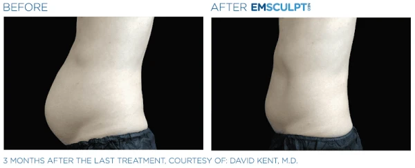 ridgway-plastic-surgery-medical-spa-4.png