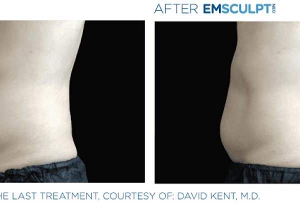 ridgway-plastic-surgery-medical-spa-4.png