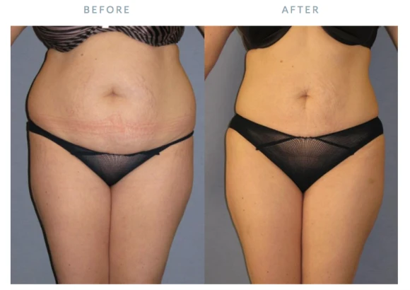 plastic-surgery-specialists-dr-stanley-g-poulos-4.png