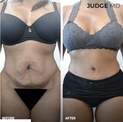 judge-md-dr-tanya-judge-3.jpg