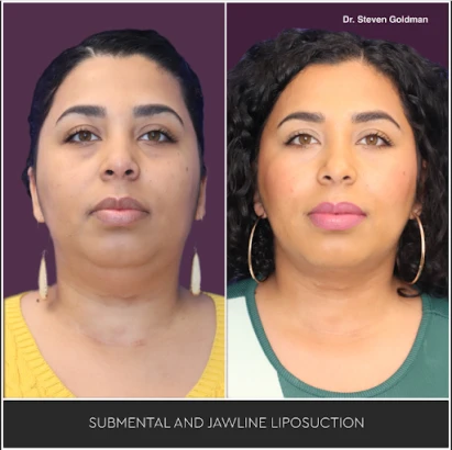 westlake-plastic-surgery-and-medical-spa-4.png