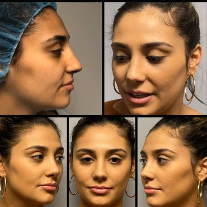 back-bay-plastic-surgery-4.jpg
