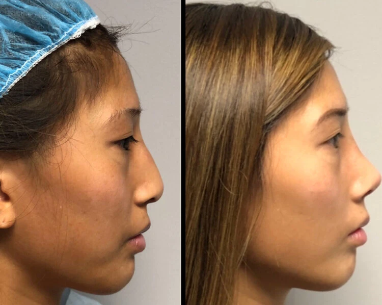Back Bay Plastic Surgery, Boston, Massachusetts, 02116