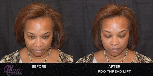 allure-laser-med-spa-3.jpg