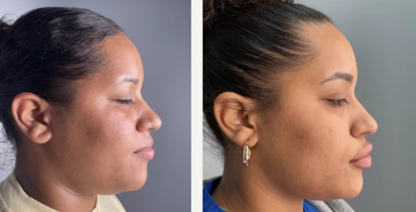 dr-falguni-patel-rejuvenate-center-for-medical-aesthetics-and-wellness-4.png