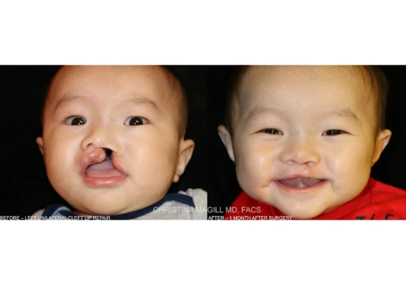 alaska-facial-plastic-surgery-ent-4.jpg