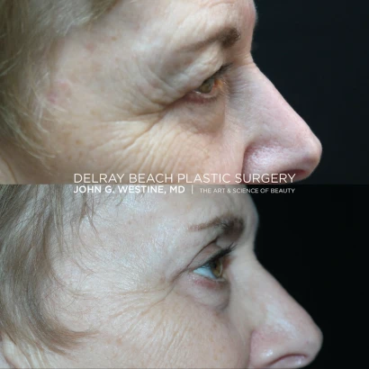 delray-beach-plastic-surgery-john-g-westine-md-3.png