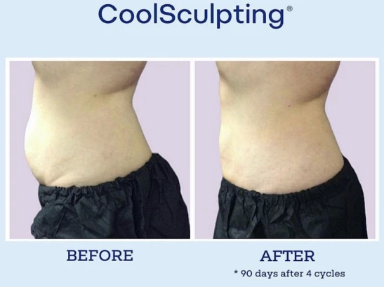 sadrian-plastic-surgery-laser-skin-care-institute-of-san-diego-3.jpg