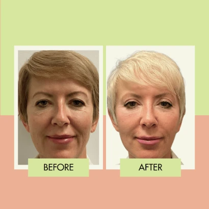adonis-plastic-surgery-3.png