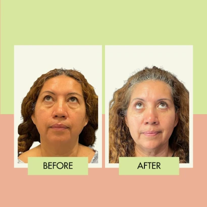 adonis-plastic-surgery-4.png