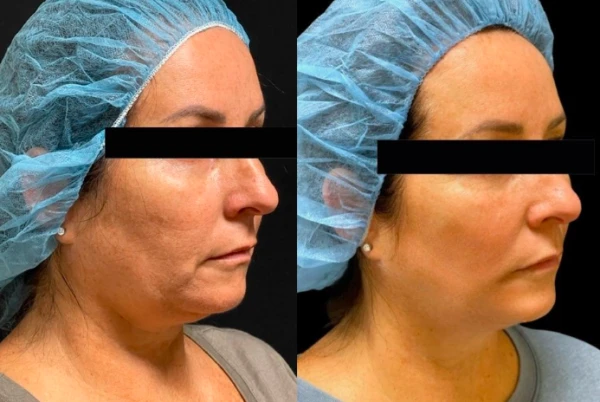 finesse-cosmetic-surgery-1.png