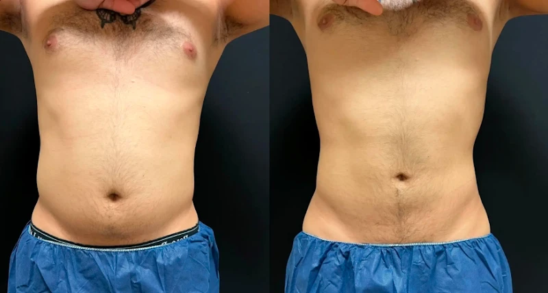 Finesse Cosmetic Surgery, Waltham, Massachusetts, 02452