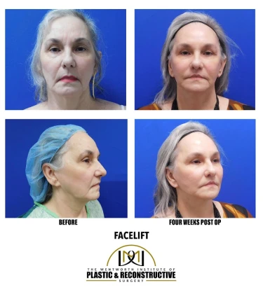 wentworth-plastic-surgery-1.jpg
