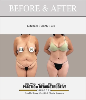 wentworth-plastic-surgery-2.jpg