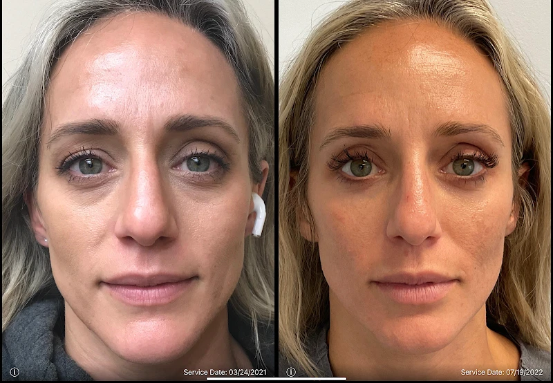 Allure Medical