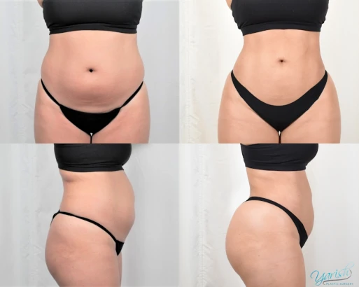 yarish-plastic-surgery-lake-jackson-drs-yarish-bartlett-4.png