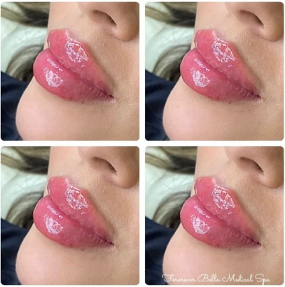 forever-bella-medical-spa-4.png