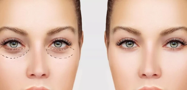 lesavoy-plastic-surgery-2.jpg