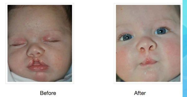 totonchi-plastic-surgery-4.png
