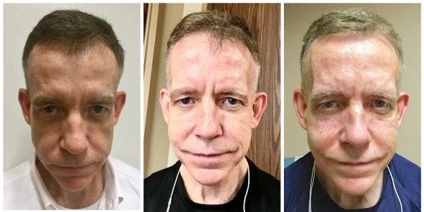 kronowitz-plastic-surgery-kingwood-4.jpg