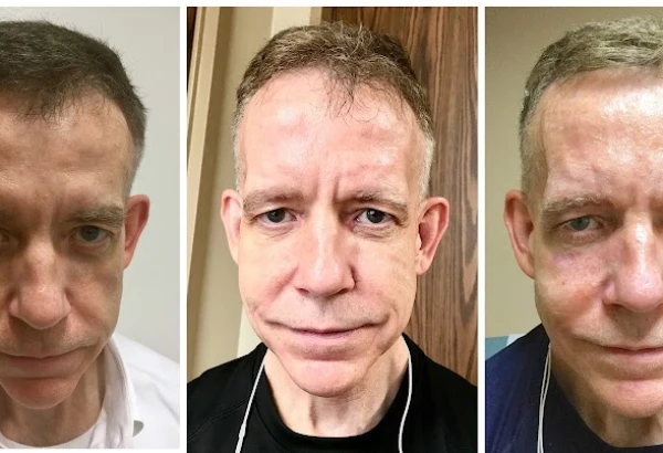 kronowitz-plastic-surgery-kingwood-4.jpg