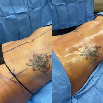 platinum-plastic-surgery-1.jpg