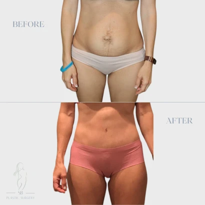 santa-barbara-plastic-surgery-center-3.png