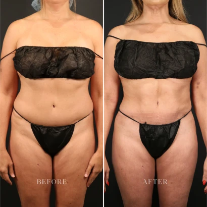 santa-barbara-plastic-surgery-center-4.png