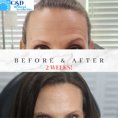 c-d-medical-aesthetics-3.png