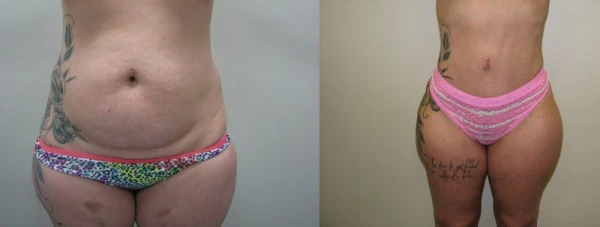 ageless-body-sculpting-wellness-1.jpg