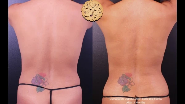 nazarian-plastic-surgery-1.jpg