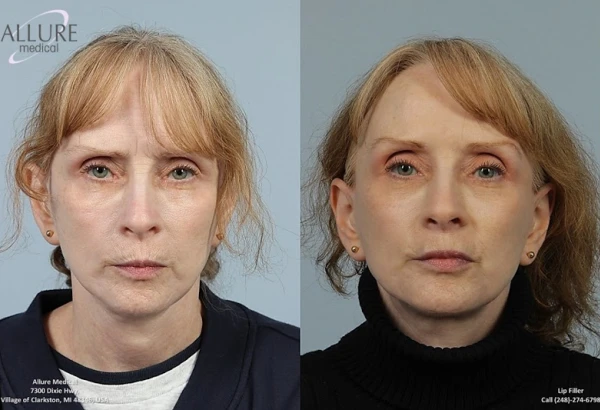 allure-medical-0.jpg
